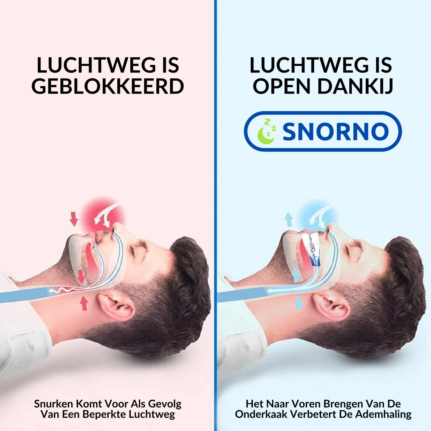 Gebruiksvriendelijk Mondstuk voor Comfortabele Nachtrust