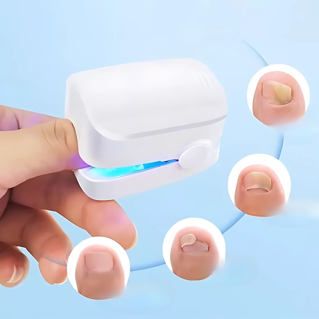 Pijnloze Infrarood Laserbehandeling voor Gezonde Nagels
