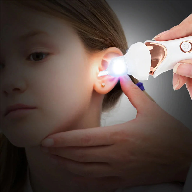 Pijnloze Oorreiniger voor Veilig Oorsmeer Verwijderen - Hygienisch en Stille Technologie