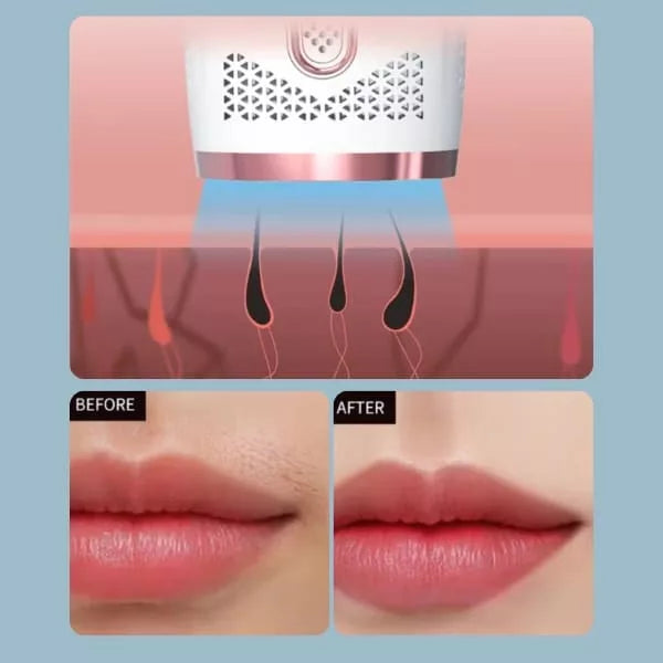 IPL Laser Ontharingsapparaat – Pijnloze Body & Facial Hair Removal