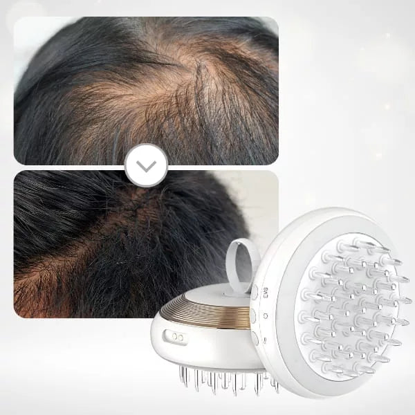 EMS Hoofdmassageborstel – Microcurrent & Vibratie voor Haarverzorging