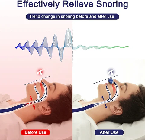 Comfortabel Draagbaar CPAP-apparaat voor Rustige Slaap