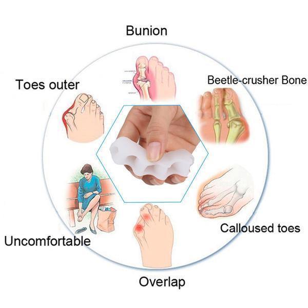 Comfortabele Corrector voor Tenen met Spreider – Ondersteuning bij Hallux Valgus
