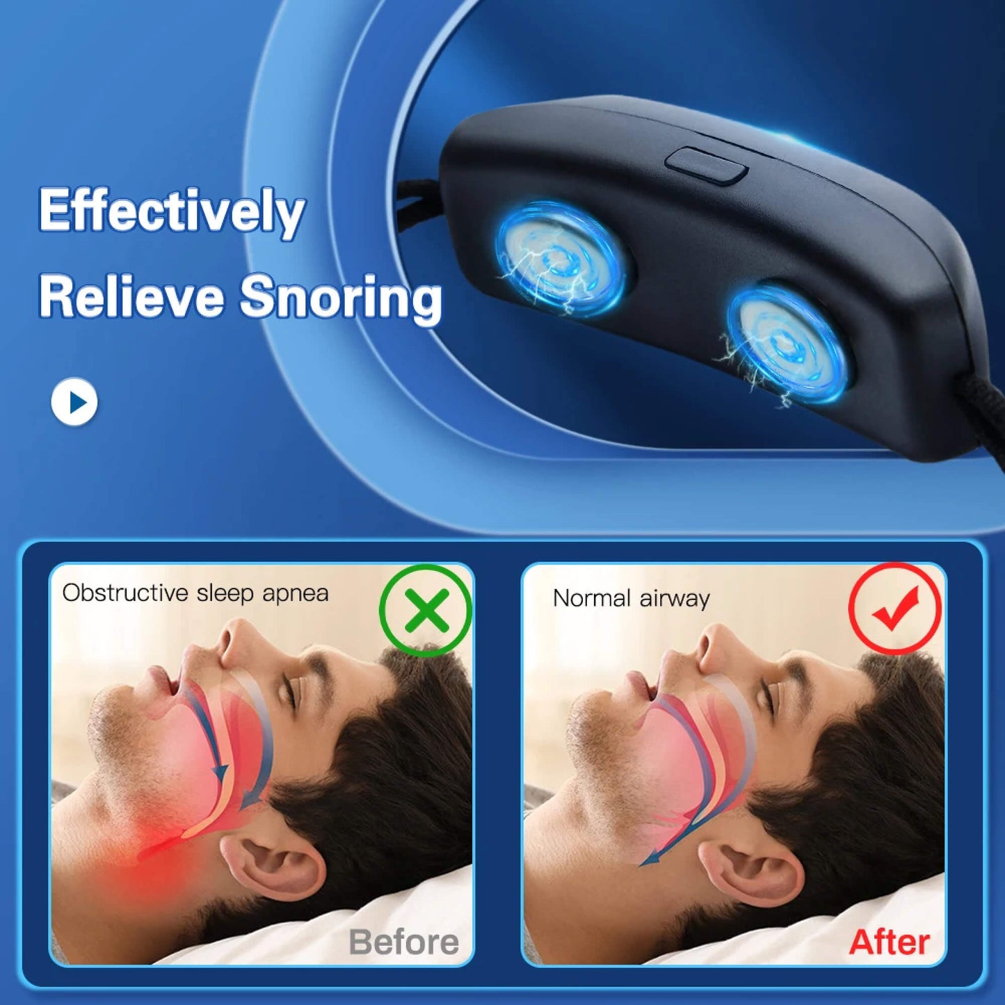 Comfortabele Kinband voor Snurkvrije Nachten – Ademhalingsondersteuning