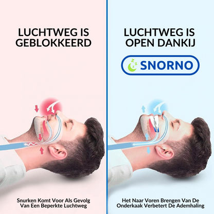 Gebruiksvriendelijk Mondstuk voor Comfortabele Nachtrust