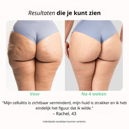 CelluFix™