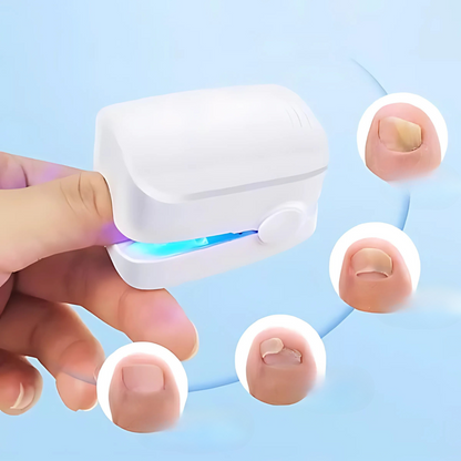 Pijnloze Infrarood Laserbehandeling voor Gezonde Nagels